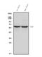 Glutamate Decarboxylase 2 antibody, M03142-1, Boster Biological Technology, Western Blot image 