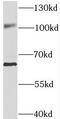 Sorting Nexin 25 antibody, FNab08089, FineTest, Western Blot image 