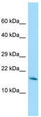 Ripply Transcriptional Repressor 1 antibody, TA333545, Origene, Western Blot image 