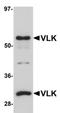 Protein kinase domain-containing protein, cytoplasmic antibody, orb75339, Biorbyt, Western Blot image 