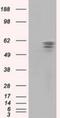Pantothenate Kinase 2 antibody, NBP2-02677, Novus Biologicals, Western Blot image 