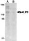 NLR Family Pyrin Domain Containing 8 antibody, LS-B6191, Lifespan Biosciences, Western Blot image 