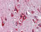 c-Myc antibody, orb329681, Biorbyt, Immunohistochemistry paraffin image 