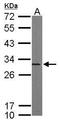 Proteasome subunit alpha type-5 antibody, GTX103845, GeneTex, Western Blot image 