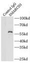 SWI/SNF-related matrix-associated actin-dependent regulator of chromatin subfamily D member 1 antibody, FNab08010, FineTest, Immunoprecipitation image 