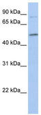 FAM20C Golgi Associated Secretory Pathway Kinase antibody, TA338411, Origene, Western Blot image 