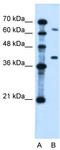 Leucine Rich Repeat Containing 26 antibody, TA336095, Origene, Western Blot image 