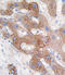 Cytochrome P450 Family 3 Subfamily A Member 5 antibody, LS-C96732, Lifespan Biosciences, Immunohistochemistry paraffin image 