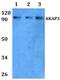 A-Kinase Anchoring Protein 3 antibody, PA5-75842, Invitrogen Antibodies, Western Blot image 