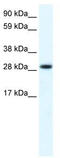 Four And A Half LIM Domains 1 antibody, TA335865, Origene, Western Blot image 