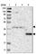 ST3 Beta-Galactoside Alpha-2,3-Sialyltransferase 6 antibody, HPA018792, Atlas Antibodies, Western Blot image 