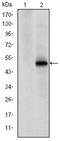 Cyclin Dependent Kinase 9 antibody, AM06623SU-N, Origene, Western Blot image 