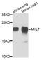 Myosin regulatory light chain 2, atrial isoform antibody, STJ26948, St John