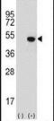 Lysine Demethylase 8 antibody, PA5-24466, Invitrogen Antibodies, Western Blot image 