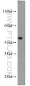 Inhibin beta A chain antibody, 22689-1-AP, Proteintech Group, Western Blot image 