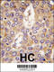 Casein Kinase 1 Gamma 2 antibody, 62-886, ProSci, Immunohistochemistry paraffin image 