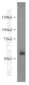 X-Prolyl Aminopeptidase 3 antibody, 15655-1-AP, Proteintech Group, Western Blot image 