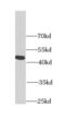 FGF1 Intracellular Binding Protein antibody, FNab03115, FineTest, Western Blot image 