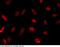 Mitogen-Activated Protein Kinase 8 antibody, 100960-T10, Sino Biological, Immunohistochemistry paraffin image 