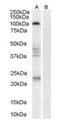 Reticulon 4 Receptor antibody, orb19023, Biorbyt, Western Blot image 