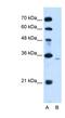 Phospholipid Phosphatase 1 antibody, NBP1-59025, Novus Biologicals, Western Blot image 