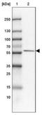 Family With Sequence Similarity 189 Member A1 antibody, NBP1-93631, Novus Biologicals, Western Blot image 