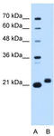 Chromosome 1 Open Reading Frame 159 antibody, TA342046, Origene, Western Blot image 