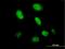 Highly divergent homeobox antibody, H00139324-B01P, Novus Biologicals, Immunocytochemistry image 