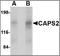 Calcium-dependent secretion activator 2 antibody, orb89164, Biorbyt, Western Blot image 