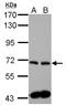 Sphingosine Kinase 2 antibody, GTX105152, GeneTex, Western Blot image 