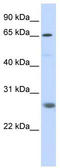 Ring Finger Protein 186 antibody, TA329880, Origene, Western Blot image 