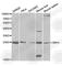 Retinol Binding Protein 4 antibody, A1600, ABclonal Technology, Western Blot image 