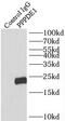 Desumoylating Isopeptidase 2 antibody, FNab06737, FineTest, Immunoprecipitation image 