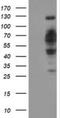DNA Cross-Link Repair 1B antibody, NBP2-03563, Novus Biologicals, Western Blot image 