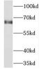 Nei Like DNA Glycosylase 3 antibody, FNab05649, FineTest, Western Blot image 