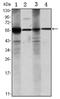 Aldehyde Dehydrogenase 1 Family Member A1 antibody, AM06513SU-N, Origene, Western Blot image 