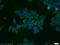 Eukaryotic Translation Initiation Factor 1A Y-Linked antibody, 11193-1-AP, Proteintech Group, Immunofluorescence image 