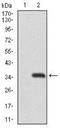 Recombination Activating 1 antibody, NBP2-37449, Novus Biologicals, Western Blot image 