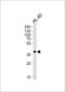 Haptoglobin-related protein antibody, LS-C165002, Lifespan Biosciences, Western Blot image 