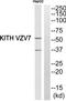 KiSS-1 receptor antibody, TA315927, Origene, Western Blot image 