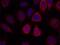 Ribosomal Protein S6 antibody, A01567, Boster Biological Technology, Immunofluorescence image 
