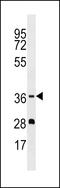 Olfactory Receptor Family 5 Subfamily M Member 1 antibody, 58-999, ProSci, Western Blot image 