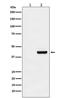 Neuraminidase antibody, M00026-5, Boster Biological Technology, Western Blot image 