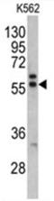 Preferentially Expressed Antigen In Melanoma antibody, AP17546PU-N, Origene, Western Blot image 