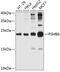 Proteasome Subunit Beta 6 antibody, 19-259, ProSci, Western Blot image 