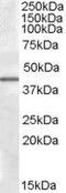 Calcium/Calmodulin Dependent Protein Kinase ID antibody, GTX88464, GeneTex, Western Blot image 