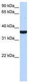 Tumor Protein P53 Inducible Protein 13 antibody, TA339908, Origene, Western Blot image 