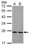 THO Complex 7 antibody, NBP2-20622, Novus Biologicals, Western Blot image 