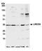 Leucine Rich Repeat Containing 59 antibody, A305-075A, Bethyl Labs, Western Blot image 
