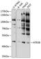 5-Hydroxytryptamine Receptor 3B antibody, 13-546, ProSci, Western Blot image 